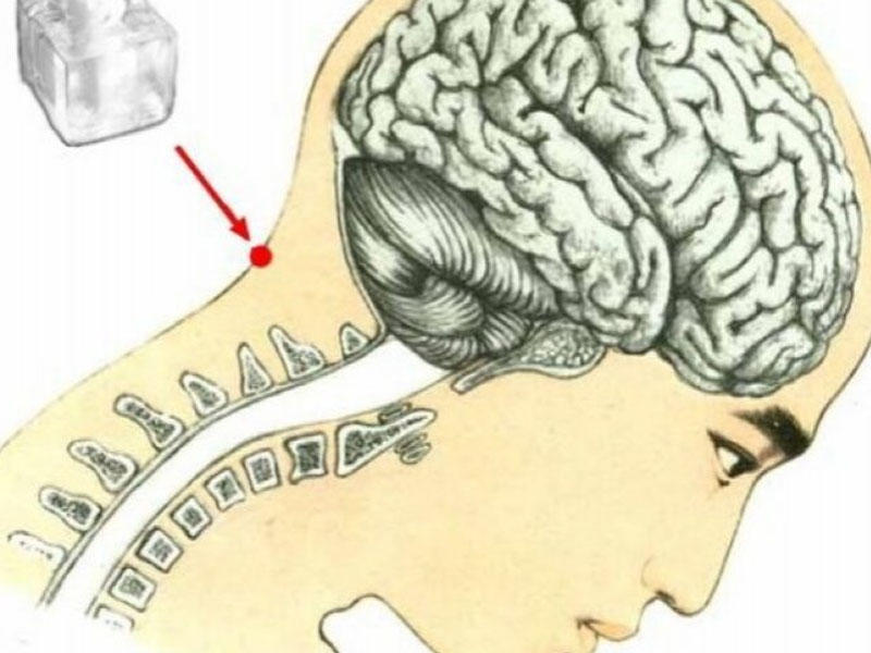 Boyundakı bu çökəyə buz qoyun, 10 yaş cavanlaşın