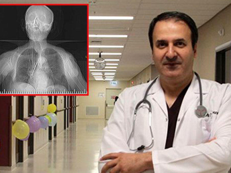 91 yaşlı kişinin ağciyərindən çıxan görənləri DƏHŞƏTƏ GƏTİRİR - VİDEO - FOTO