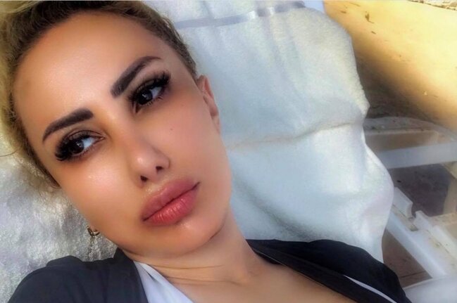 Təranə çimərlik geyimində foto yaydı