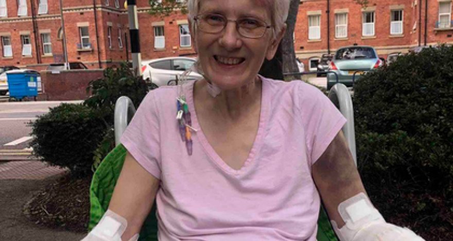 Женщина попала в больницу с камнями в почках и лишилась конечностей