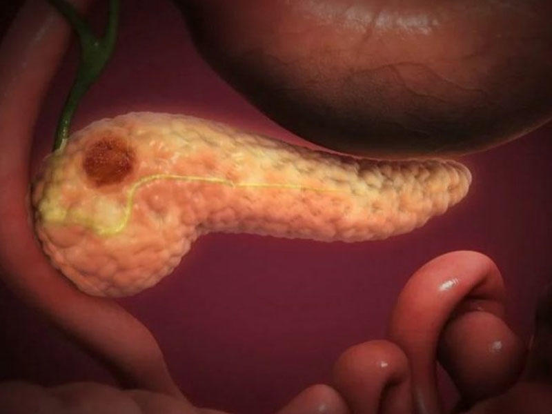 Hansı dərmanlar mədəaltı vəzin 