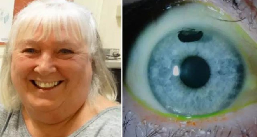 Татуировки на глазах заменили британке очки