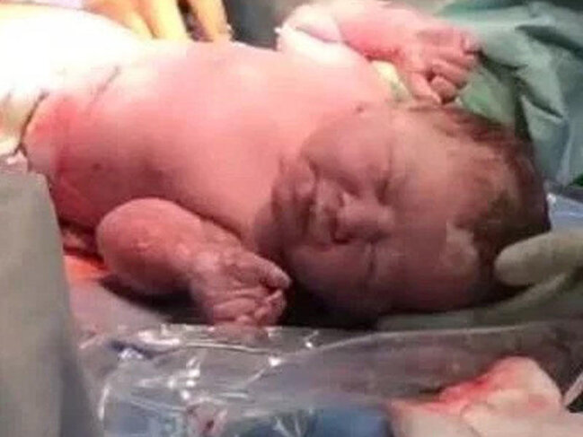 Uşaq anasının bətnindən çıxan kimi yatdı - Doğum evində maraqlı görüntülər - FOTOLAR
