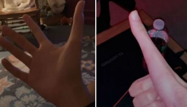 Американец поразил пользователей Сети очень длинным пальцем - ВИДЕО