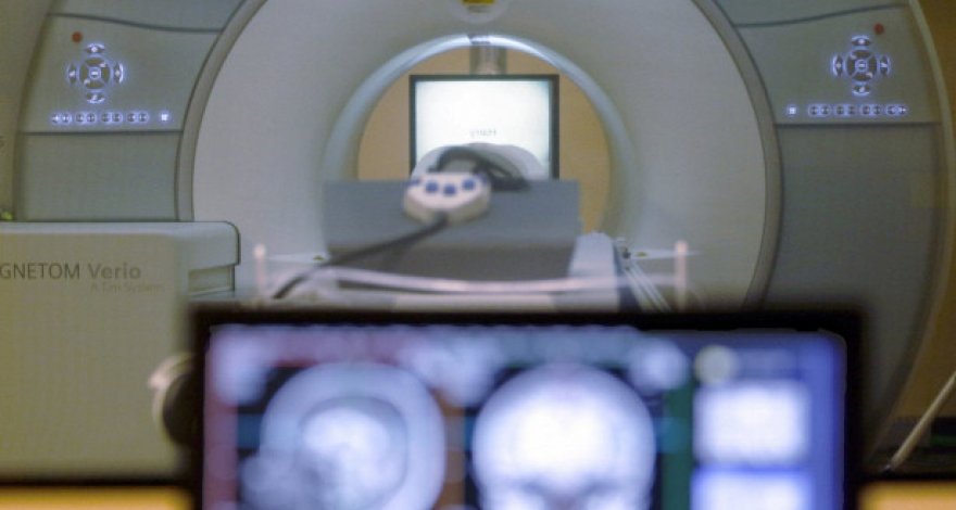 Искусственный мозг впервые подумал