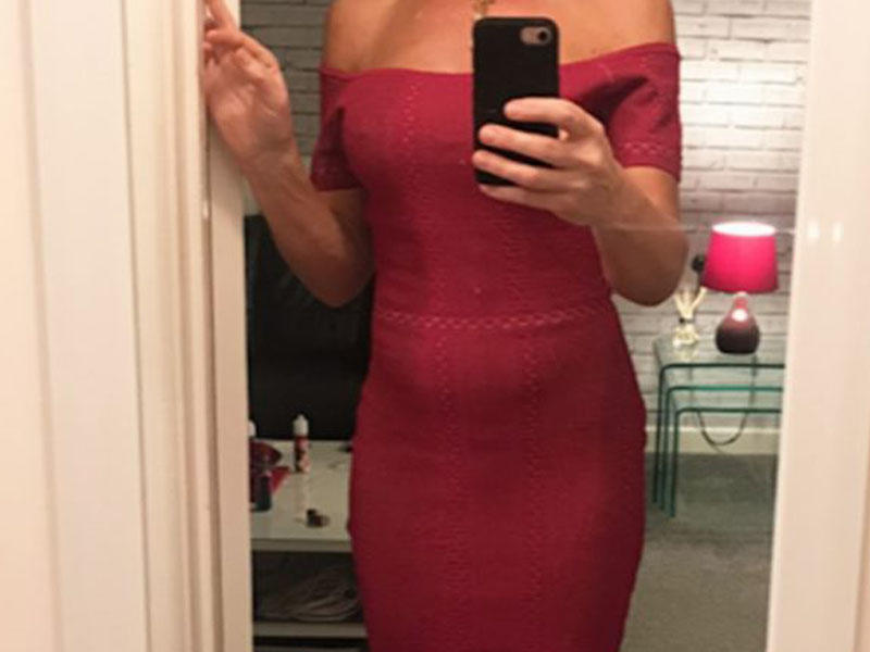 Sinə və piyçəkmə əməliyyatına 8000 manat ödəyən qadın eybəcər hala düşdü - FOTO