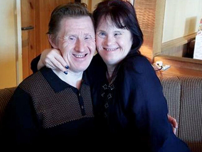 Dünyanın ilk Daun sindromlu evli cütlüyü - Gündə 100 dəfə 