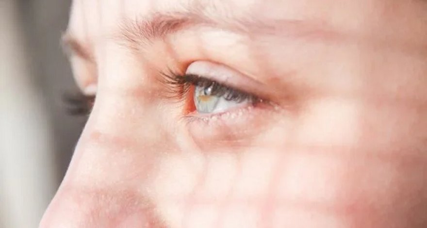 Женщина плохо умывалась и расплодила на глазах полчища паразитов