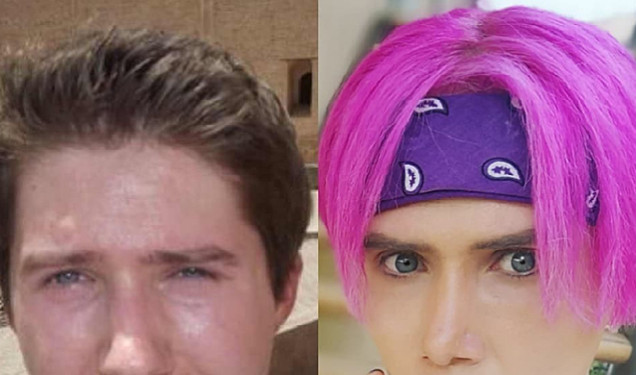 Müğənniyə oxşamaq üçün 15 dəfə əməliyyat olundu - Fotolar