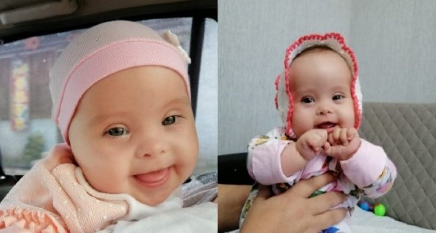 Как получить пенсию на ребенка с синдромом Дауна? Мучения матери 7-месячной дочери на примере Лалы Аслановой