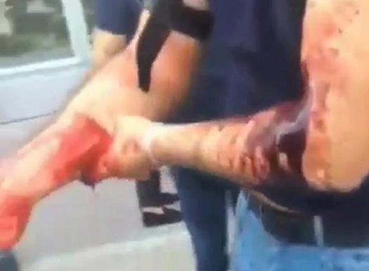 Bakının mərkəzində dəhşətli anlar – Hamının gözü qarşısında qana boyadılar – VİDEO