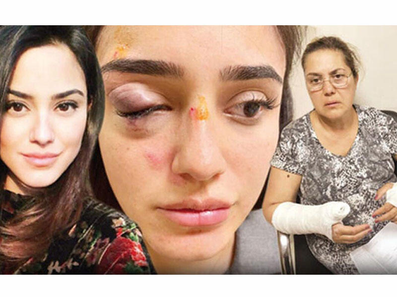 İş adamı hamilə sevgilisini küçədə döyüb bu günə qoydu - FOTO