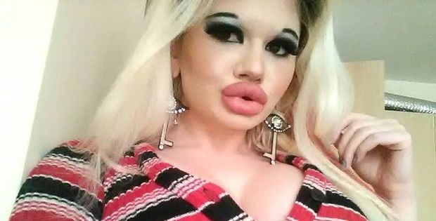 Студентка намерена сделать себе самые большие губы в мире - ФОТО
