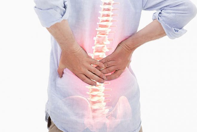 Bel yırtığı daha çox kimlərdə olur? - Vacib məlumatlar