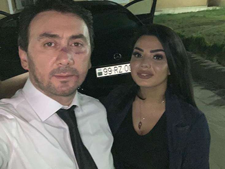 İranlılar Aqşinin 2 milyonluq klipini sildirdi - FOTO