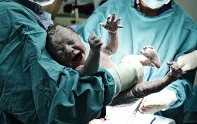 Bakıda 32 yaşlı qadın doğuş zamanı öldü