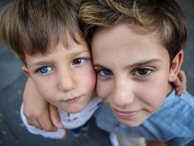 Dünyanı iki fərqli göz rəngi ilə görən qardaşlar
