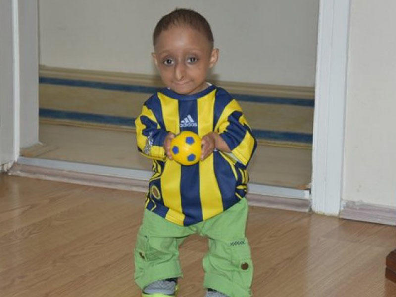 14 yaşı var, cəmi 4 kilodur -