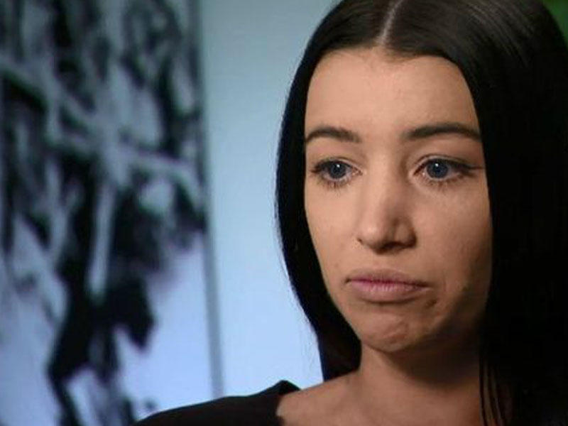 Dodaqlarını böyütmək istəyən qadın kor qalacaqdı - FOTO