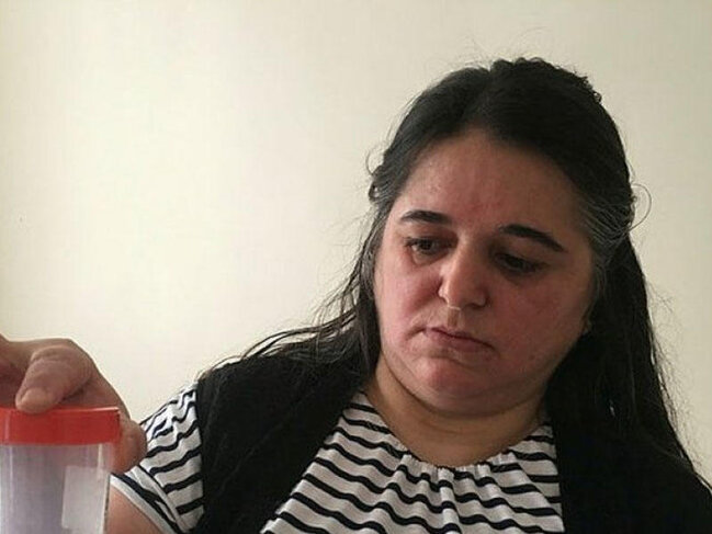 Qadının mədəsindən çıxan həkimləri şoka saldı