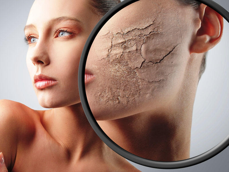 Dərisi quruyanlar, bu vasitəni atın - Nə istifadə etməli?