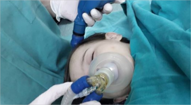 Bakıda qələmin başlığı azyaşlının boğazında qaldı - SON ANDA....