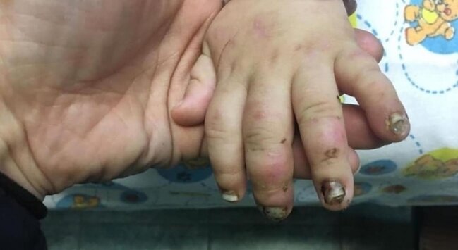 19 yaşlı qız oğlunu vəhşicəsinə döyüb sevgilisilə görüşə getdi