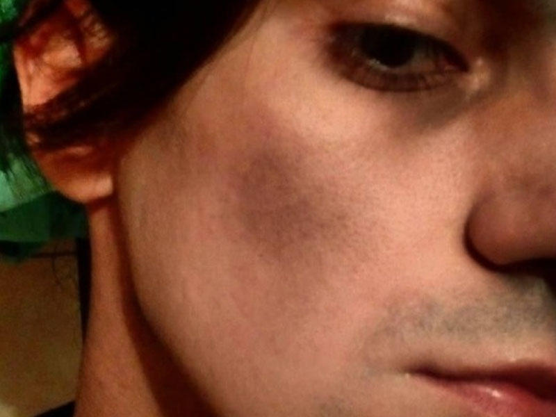 Rusiyanın Xalq artistinin “azərbaycanlı oğlu” Moskvada döyüldü - FOTO