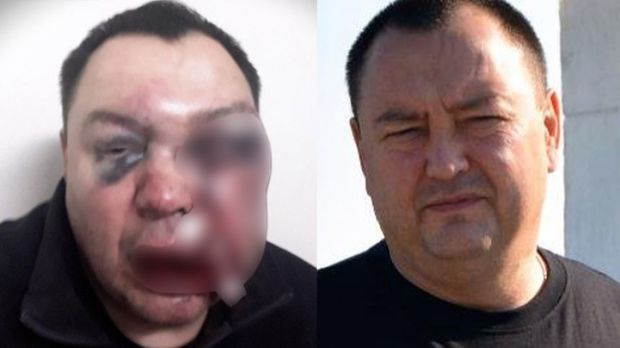 Российского депутата избили железной трубой