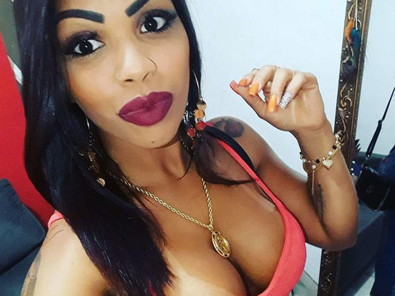 Omba böyütmə əməliyyatı keçirən 3 uşaq anasının budlarında dəliklər əmələ gəldi - FOTO