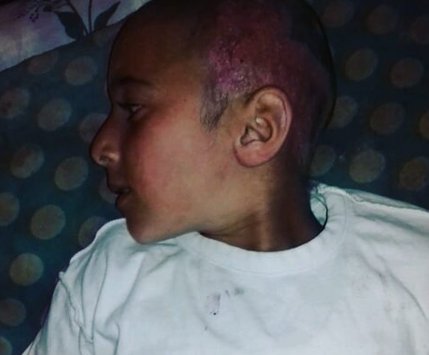 Azərbaycanda atalığından şiddət görən 11 yaşlı uşaq qəbiristanlıqda gizlənib - FOTO