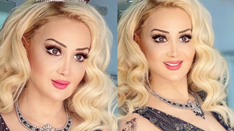 Xalq artisti hönkürtüsünü gülüşündə GİZLƏTDİ