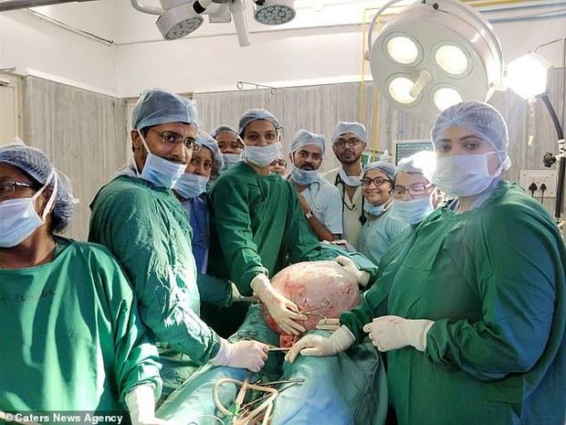 Hamilə olduğunu zənn edən qadının qarnından 18 kiloqramlıq şiş çıxdı - FOTO