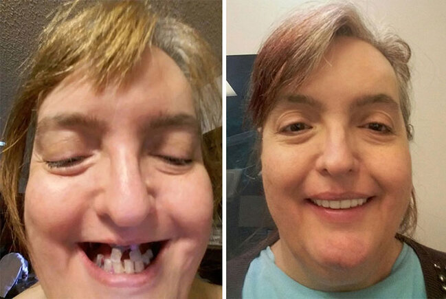 O, insanlara gözəl təbəssümü qaytarır - özü də PULSUZ - FOTO