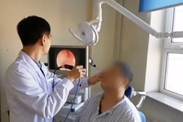 Мужчина десятки лет жил с зубом в носу - ВИДЕО