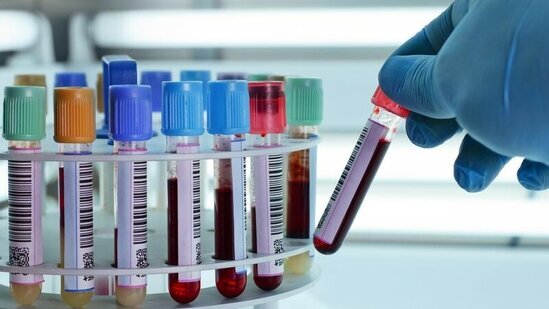 Azərbaycanın qonşuluğunda QİÇS TƏHLÜKƏSİ: 8 min nəfər bu xəstəliyə yoluxub