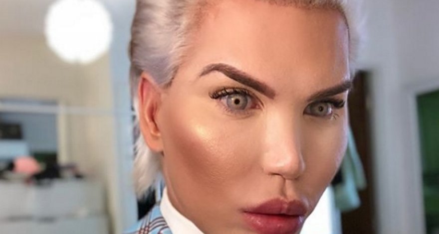 «Живой Кен» избавился от ненастоящего пресса ради следующей безумной операции