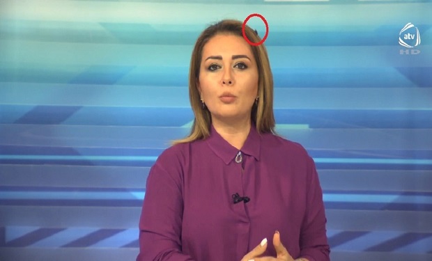 ATV-nin məşhur aparıcısının canlı yayımda milçəklə sınağı — VİDEO