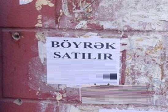 Bakıda böyrəyini satışa çıxaran qadınla bağlı ŞOK XƏBƏR