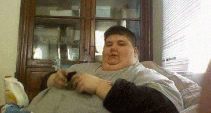 Женщина смогла победить рак и похудеть на 226 кг благодаря удалению языка – ФОТО