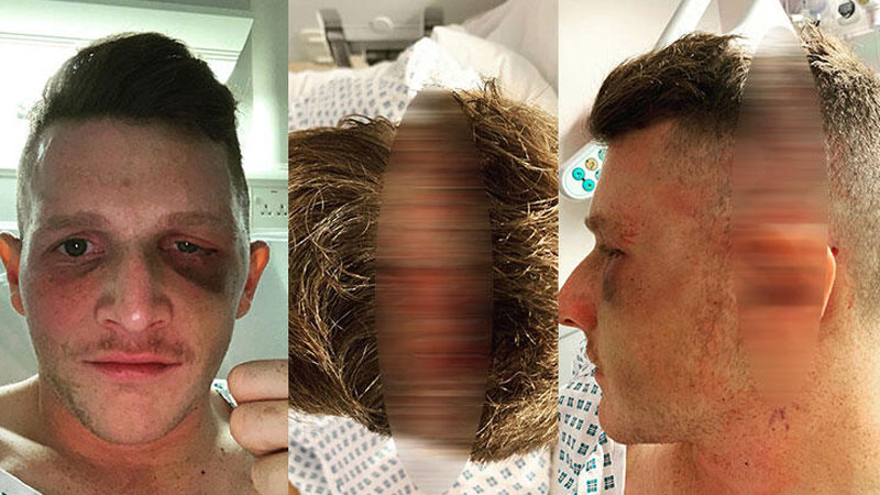 Dəhşətli hadisə: Məşhur oyunçu matçda kor oldu - FOTOLAR