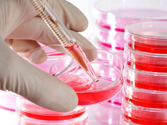 İranda 60 min nəfər QİÇS-ə yoluxub