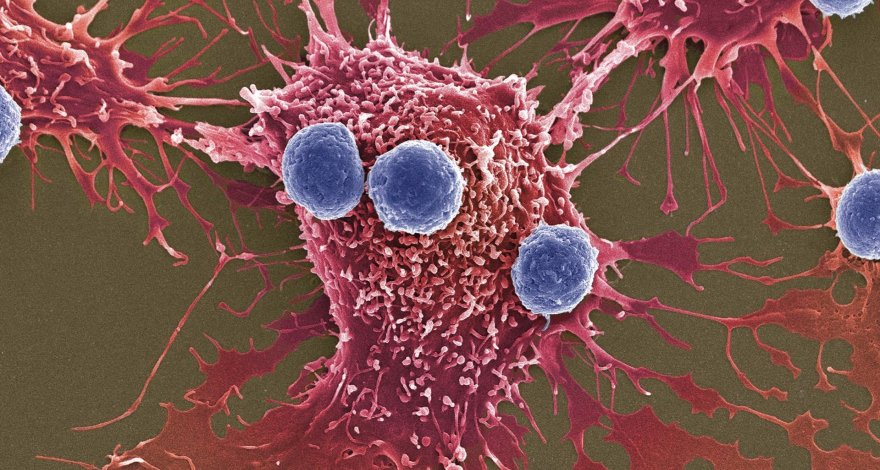 Обнаружены вещества, способные «пробуждать» лимфоциты для борьбы с раком