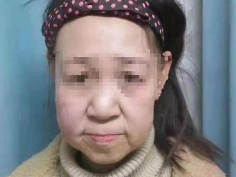 15 yaşlı qız qoca qarı kimi görünür - Təhqir olundu, məktəbi atdı - FOTO