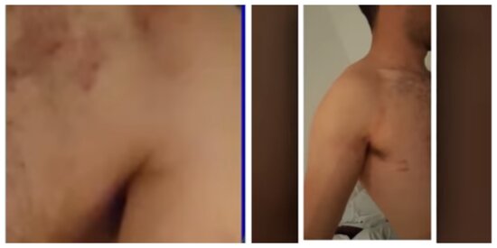 Azərbaycanda BİABIRÇILIQ - Gənci soyundurub kafenin qarşısına atdılar - FOTOLAR