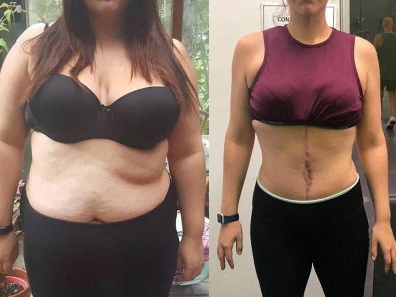 Erotik fantaziyasına görə 63 kq arıqlayan qadın görənləri təəccübləndirir - FOTO