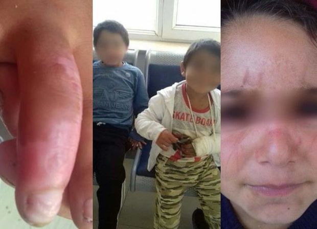 Bakıda uşaqların ögey anaları tərəfindən döyülməsi faktı ilə bağlı araşdırmalara başlanıldı