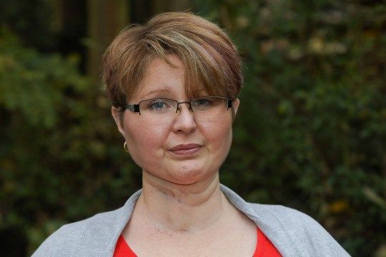 Врачи восстановили язык пациентки, взяв кожу и мышцы с ее руки - ФОТО