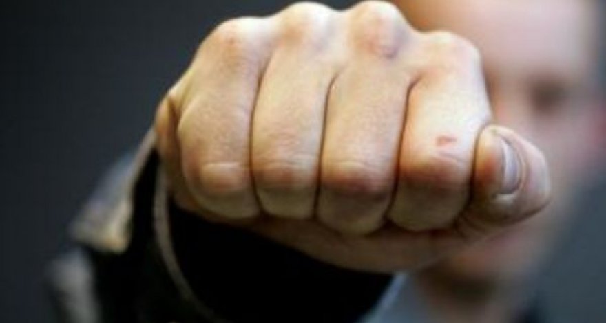 В Баку молодому парню в драке сломали челюсть