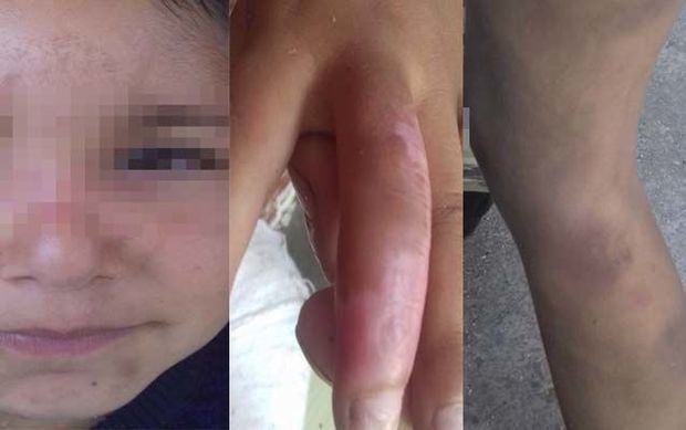 По факту избиения детей отцом и мачехой возбуждено уголовное дело